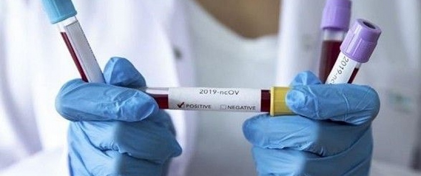 В Мозыре зарегистрирован первый случай заболевания COVID-19.